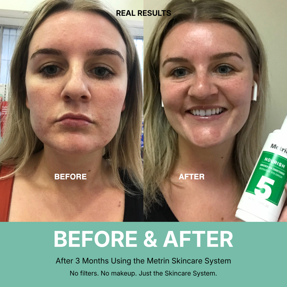 September Skincare